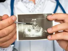 Wake Tech Cardiovascular Sonography program image